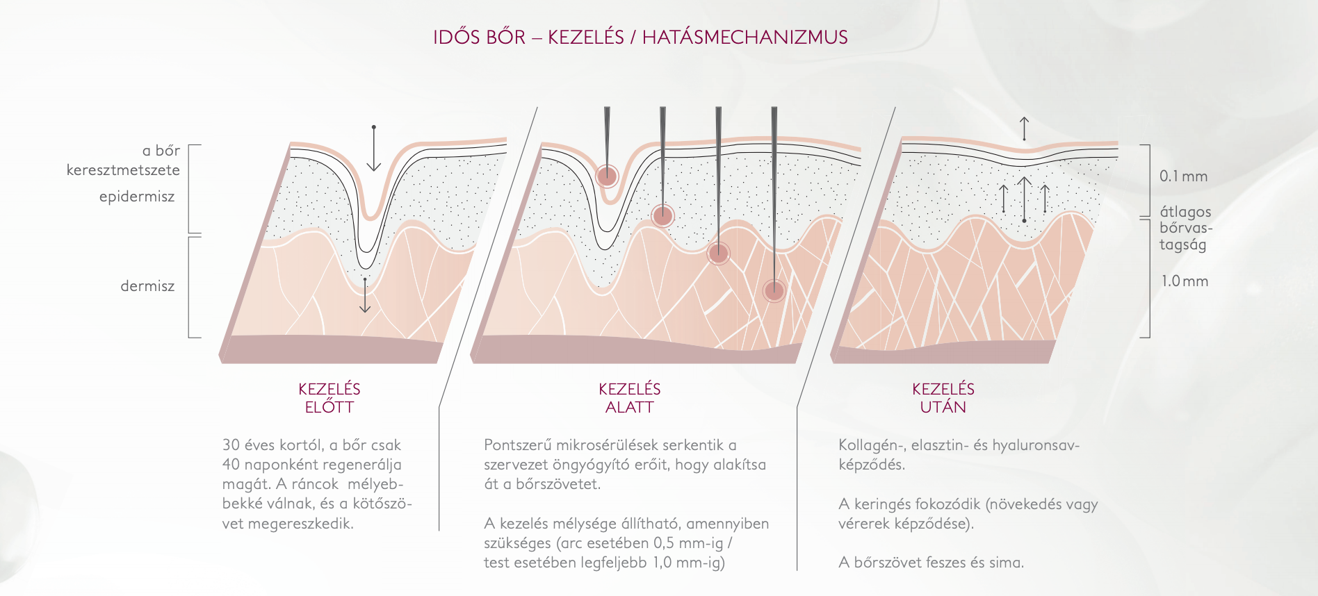 SkinNeedler mezoterápiás kezelések